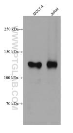 CD31 Antibody in Western Blot (WB)