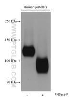 CD31 Antibody in Western Blot (WB)