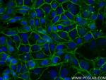 E-cadherin Antibody in Immunocytochemistry (ICC/IF)