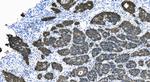 E-cadherin Antibody in Immunohistochemistry (Paraffin) (IHC (P))