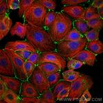 Occludin Antibody in Immunocytochemistry (ICC/IF)