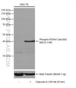 Phospho-PDH E1 Alpha (Ser300) Antibody in Western Blot (WB)