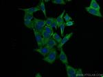 NRF2, NFE2L2 Antibody in Immunocytochemistry (ICC/IF)