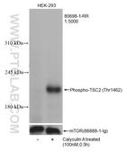 Phospho-TSC2 (Thr1462) Antibody in Western Blot (WB)