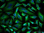 Beta Tubulin Antibody in Immunocytochemistry (ICC/IF)