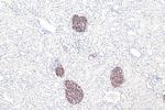 SYNPO Antibody in Immunohistochemistry (Paraffin) (IHC (P))