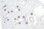 SYNPO Antibody in Immunohistochemistry (Paraffin) (IHC (P))