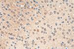 SYNPO Antibody in Immunohistochemistry (Paraffin) (IHC (P))