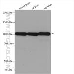 SYNPO Antibody in Western Blot (WB)
