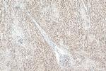HSP70 Antibody in Immunohistochemistry (Paraffin) (IHC (P))