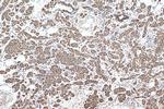 HSP70 Antibody in Immunohistochemistry (Paraffin) (IHC (P))