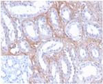 FGF23 (Fibroblast Growth Factor 23) Monoclonal Antibody (FGF23/4171)