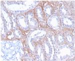 FGF23 (Fibroblast Growth Factor 23) Monoclonal Antibody (FGF23/4171)