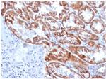 FGF23 (Fibroblast Growth Factor 23) Monoclonal Antibody (FGF23/4169)