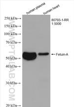 Fetuin-A Antibody in Western Blot (WB)