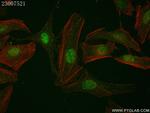 p38 MAPK Antibody in Immunocytochemistry (ICC/IF)