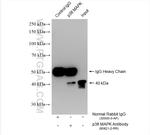 p38 MAPK Antibody in Immunoprecipitation (IP)