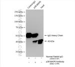 p38 MAPK Antibody in Immunoprecipitation (IP)