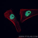 MYC Antibody in Immunocytochemistry (ICC/IF)