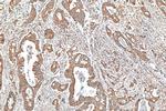 GRP78, BIP Antibody in Immunohistochemistry (Paraffin) (IHC (P))