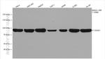 DDX21 Antibody in Western Blot (WB)