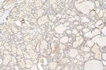 HIF-1 alpha Antibody in Immunohistochemistry (Paraffin) (IHC (P))