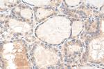 HIF-1 alpha Antibody in Immunohistochemistry (Paraffin) (IHC (P))