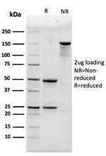 Alpha Actinin 4/ACTN4 Monoclonal Antibody (93)