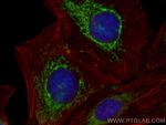 OXCT1 Antibody in Immunocytochemistry (ICC/IF)