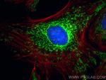 OXCT1 Antibody in Immunocytochemistry (ICC/IF)