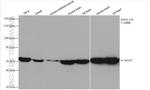 OXCT1 Antibody in Western Blot (WB)