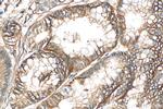 S100A10 Antibody in Immunohistochemistry (Paraffin) (IHC (P))