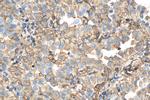 S100A10 Antibody in Immunohistochemistry (Paraffin) (IHC (P))