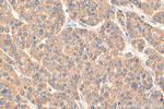 DHFR Antibody in Immunohistochemistry (Paraffin) (IHC (P))
