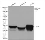 GFAP Antibody in Western Blot (WB)