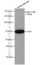AFP Antibody in Western Blot (WB)