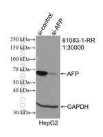 AFP Antibody in Western Blot (WB)