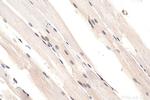 YAP1 Antibody in Immunohistochemistry (Paraffin) (IHC (P))