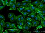 Beta Actin Antibody in Immunocytochemistry (ICC/IF)