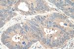 MYH9 Antibody in Immunohistochemistry (Paraffin) (IHC (P))