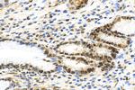 PCNA Antibody in Immunohistochemistry (Paraffin) (IHC (P))