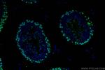 PCNA Antibody in Immunohistochemistry (PFA fixed) (IHC (PFA))