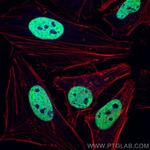 TDP-43 Antibody in Immunocytochemistry (ICC/IF)