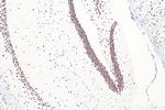 TDP-43 Antibody in Immunohistochemistry (Paraffin) (IHC (P))