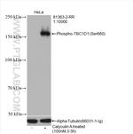 Phospho-TBC1D1 (Ser660) Antibody in Western Blot (WB)