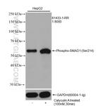 Phospho-SMAD1 (Ser214) Antibody in Western Blot (WB)