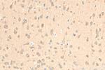 PPAR Gamma Antibody in Immunohistochemistry (Paraffin) (IHC (P))