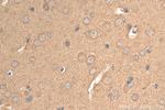 ENO1/2/3 Antibody in Immunohistochemistry (Paraffin) (IHC (P))