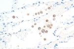 CD206 Antibody in Immunohistochemistry (Paraffin) (IHC (P))