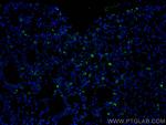CD206 Antibody in Immunohistochemistry (PFA fixed) (IHC (PFA))